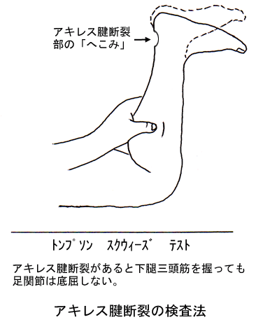 トンプソンテスト