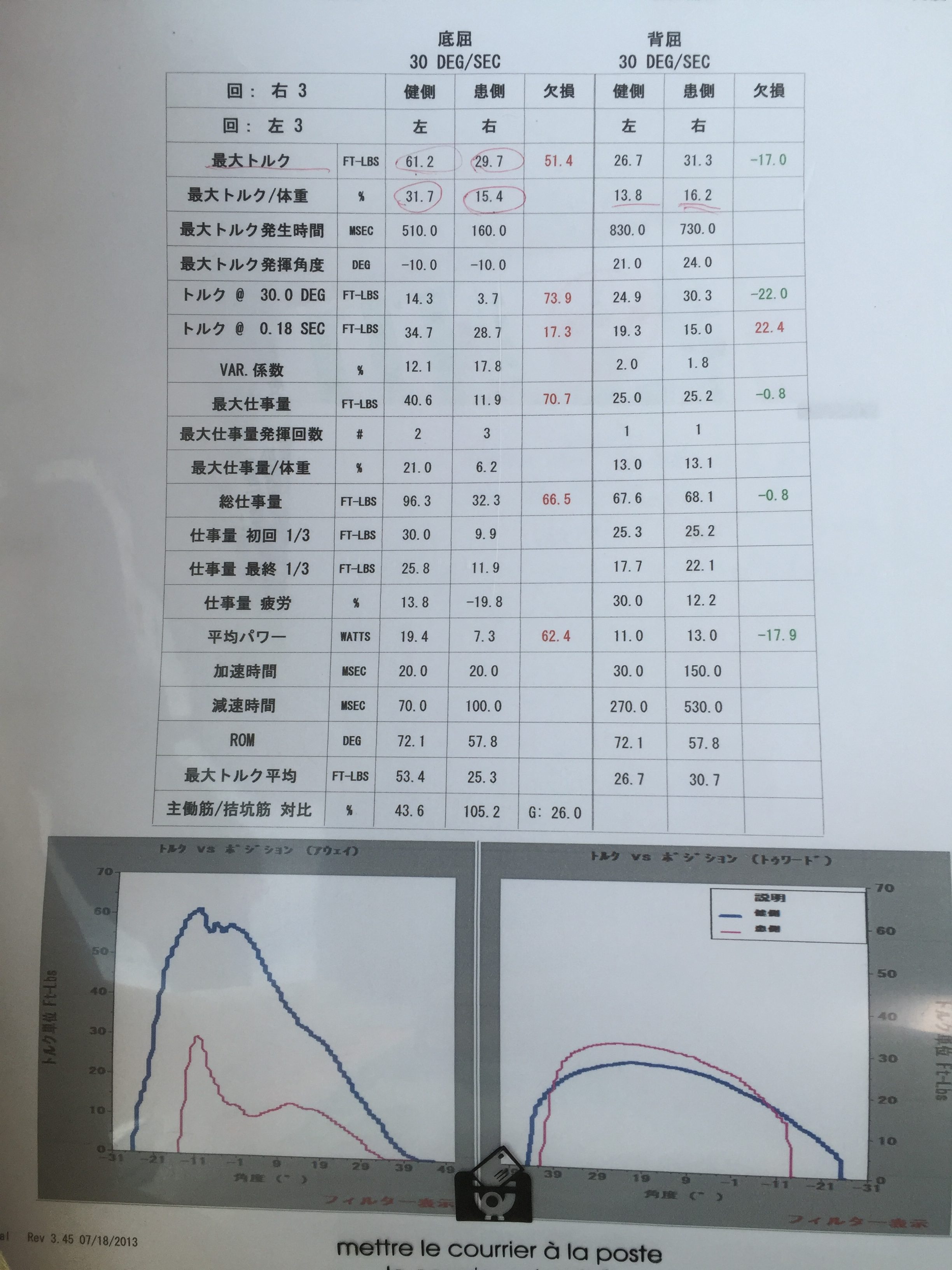 アキレス腱断裂測定
