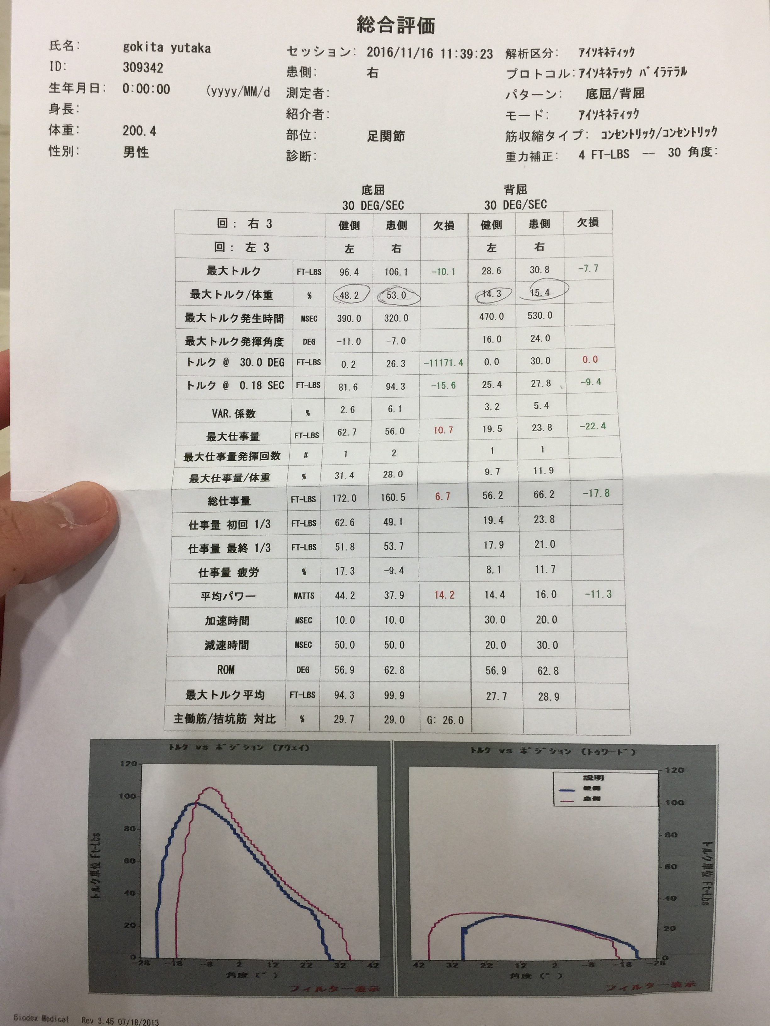 アキレス腱断裂　測定