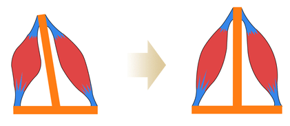 マッスルインバランス